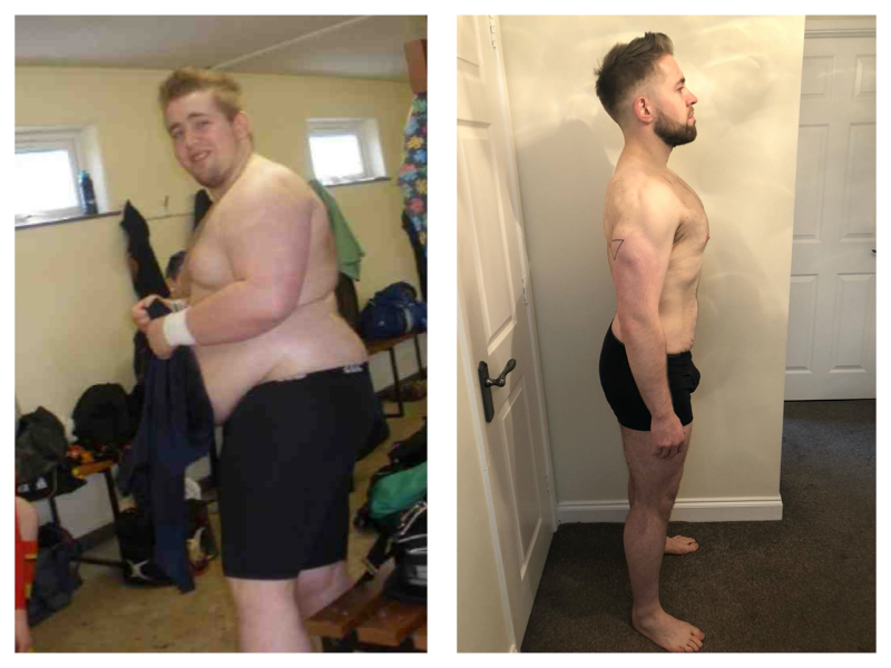 A Side By Side Image Of The Belfast Nutritionist Who Was 154KG And Dropped Down To 82KG